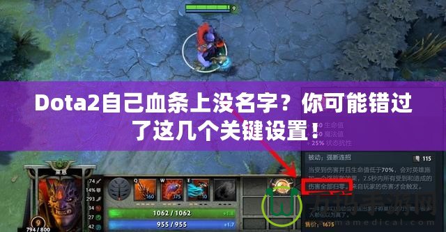 Dota2自己血條上沒名字？你可能錯(cuò)過了這幾個(gè)關(guān)鍵設(shè)置！